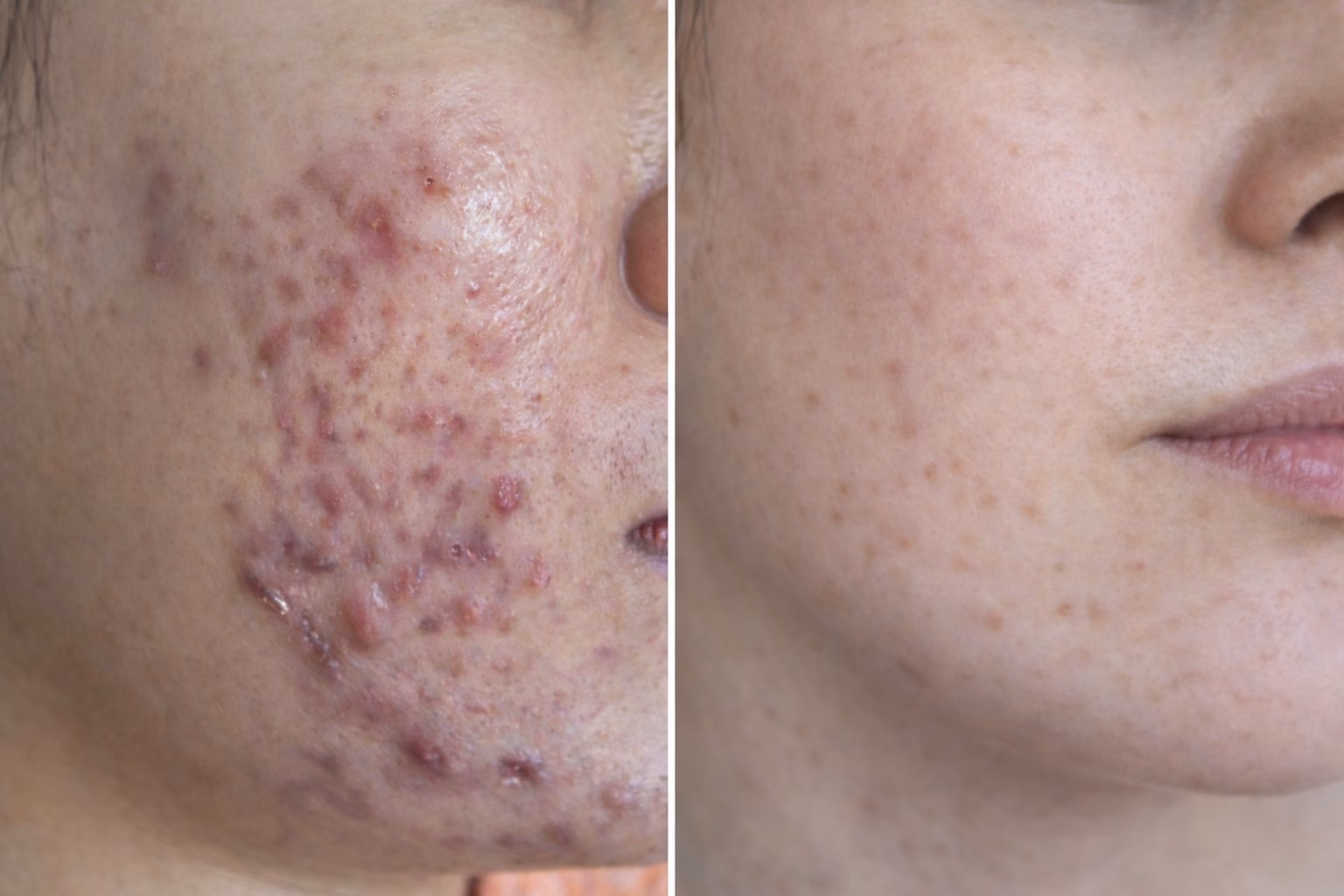 Skin Transformation - Problems